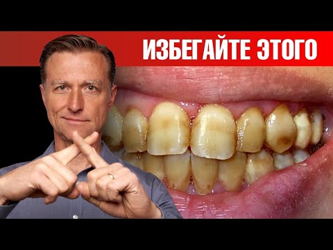 Видео: Худшая пища для зубов. И это НЕ САХАР! 😲