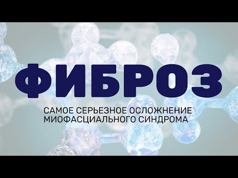 Видео: Фиброз мышц. Исследования Миофасциального синдрома. Как возникают триггерные точки и фиброз