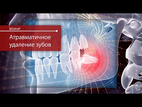 Видео: Атравматичное удаление зубов