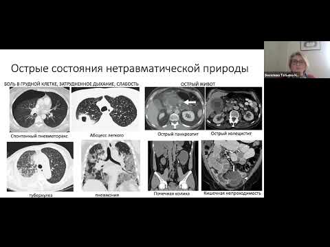 Видео: Рентгенологическая диагностика в КардиоБИТе Веселова Т.Н.