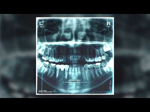 Видео: Johnyboy - В неожиданном ракурсе (Ib17 Round 5)