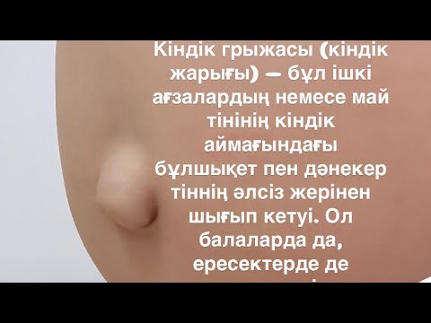 Видео: Кіндік грыжасы кезинде массаж жасау. При Пупочный грыжа массаж.