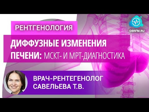 Видео: Врач-рентгенолог Савельева Т.В.: Диффузные изменения печени: МСКТ- и МРТ-диагностика