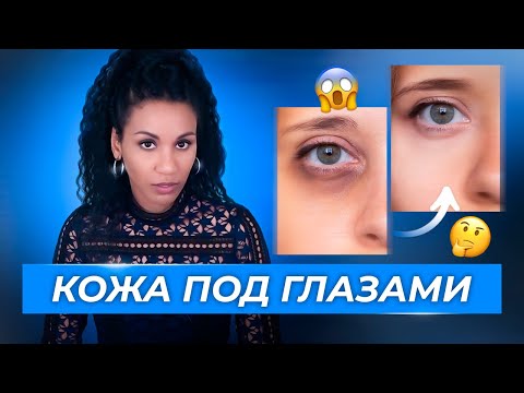 Видео: Как убрать тёмные круги и отёки под глазами? // Эффект панды🐼: простой рецепт для осветления кожи