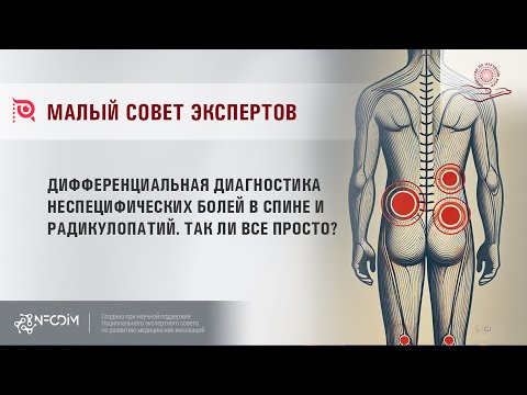 Видео: Дифференциальная диагностика неспецифических болей в спине и радикулопатий. Так ли все просто?