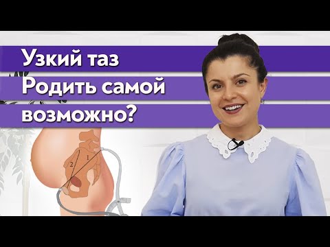 Видео: Узкий таз при беременности / Может ли ребенок застрять во время родов?