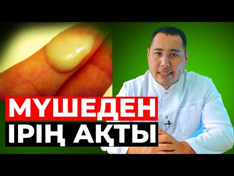 Видео: Мүшеден ірің ағуы! Ифекцияны қалай емдейміз?