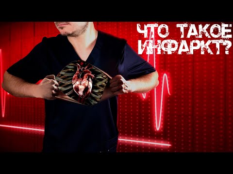 Видео: Что такое инфаркт? | Электростанция внутри нас | Что произошло с Ельциным в 1996? | Просто о сердце