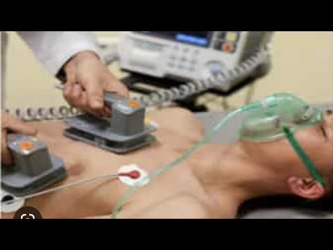 Видео: Обзор мегакода ACLS — нестабильная тахикардия и синхронизированная кардиоверсия