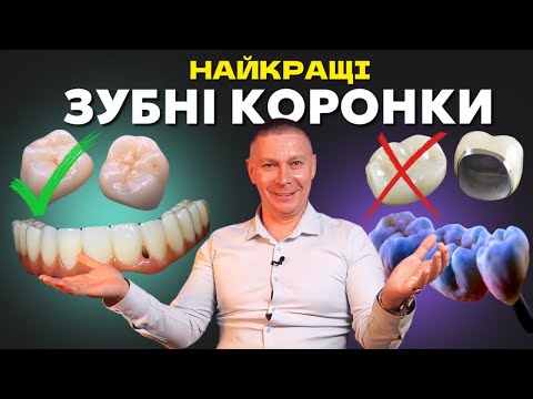 Видео: Яку коронку поставити у 2025? Сучасні зубні коронки. Металокераміка, E-max, діоксид цирконію