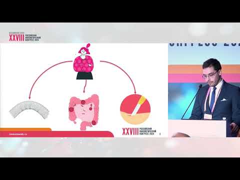 Видео: Стенозирующие опухоли ободочной кишки: стент, стома или хирургия upfront?