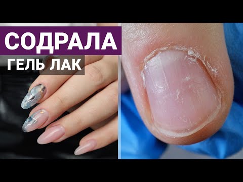 Видео: База для ПОВРЕЖДЁННЫХ ногтей 💅 СОДРАЛА гель лак 🤷🏼‍♀️ Маникюр "ТЕКСТУРЫ" и наращивание ногтей