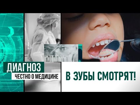 Видео: По чём зубы для народа? | Диагноз