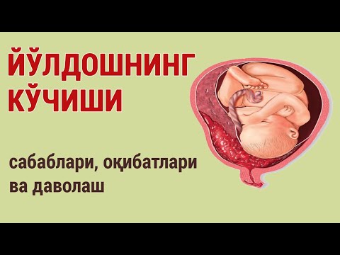 Видео: Йўлдошнинг кўчиши: сабаблари, оқибатлари ва даволаш