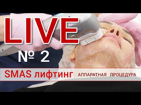 Видео: Аппаратный SMAS лифтинг. Полная процедура выполняется врачом-косметологом Юлианой Шиян
