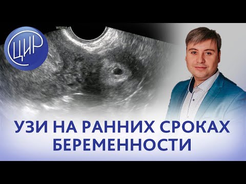 Видео: УЗИ на ранних сроках. Задачи врача ультразвуковой диагностики на ранних сроках беременности.