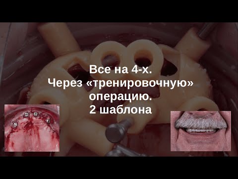 Видео: Сначала тренировка. 2 шаблона.