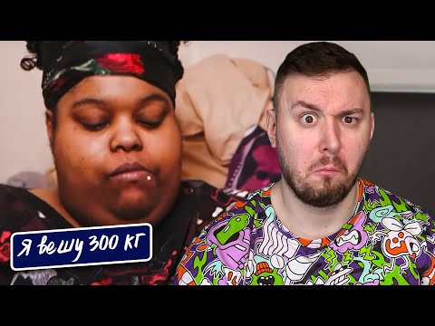 Видео: Я вешу 300 кг ► 18 выпуск   7 сезон ► Мерседес Сефас
