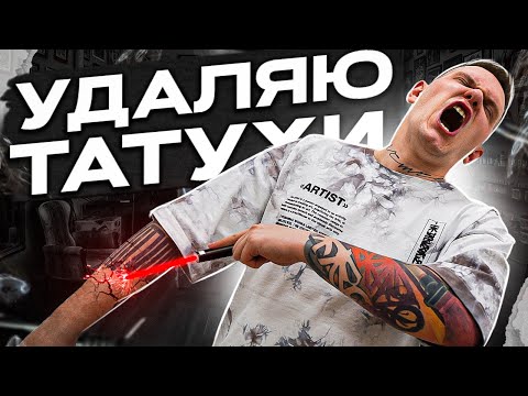 Видео: УДАЛЕНИЕ ТАТУ ЛАЗЕРОМ и не только! | Клиника DELETE, ремувер, результат ДО И ПОСЛЕ.