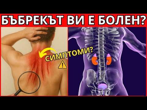 Видео: 10 ПРЕДУПРЕДИТЕЛНИ СИМПТОМА, ЧЕ БЪБРЕЦИТЕ ВИ ОТКАЗВАТ