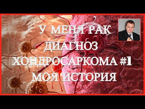 Видео: У меня рак - диагноз #Хондросаркома  ➠ pT2bNO(0/9) Stage IB. #1 Моя история.💊 💉🆘🎥