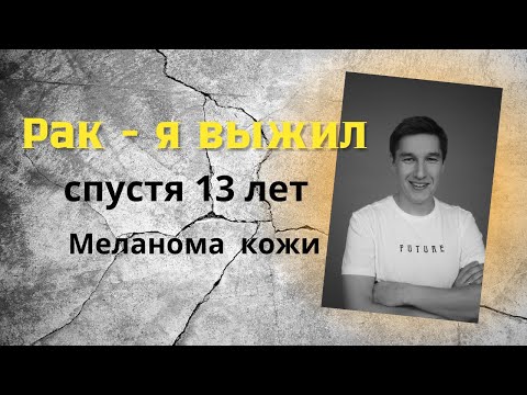 Видео: Рак кожи, спустя 13 лет (Меланома)