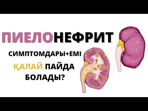 Видео: ПИЕЛОНЕФРИТ ЕМІ ҚАНДАЙ ? ҚАЛАЙ ПАЙДА БОЛАДЫ ? ҮЙ ЖАҒДАЙЫНДА ЕМДЕУГЕ БОЛАМА?