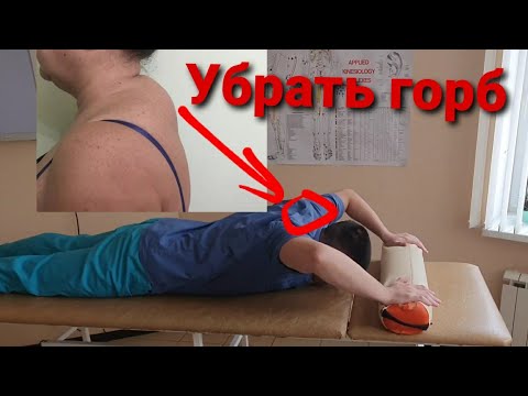 Видео: Упражнения для шеи. Как убрать холку на шее, "вдовий горб", увеличить подвижность плечевого сустава