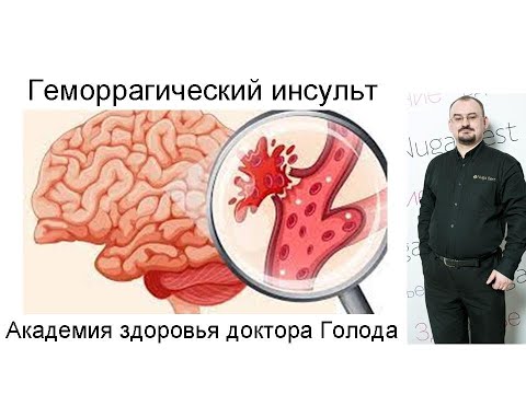 Видео: Геморрагический инсульт – его виды, проявления и лечение.