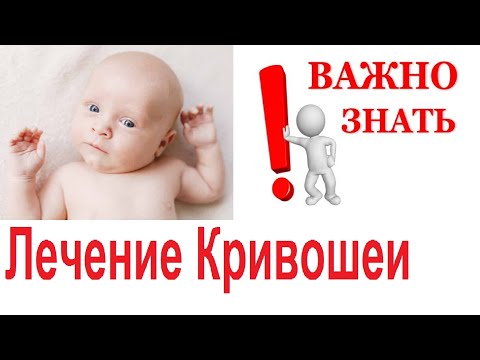 Видео: Лечение Кривошеи. Как Носить Ребенка При Кривошее