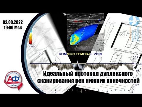 Видео: Идеальный протокол дуплексного сканирования вен нижних конечностей