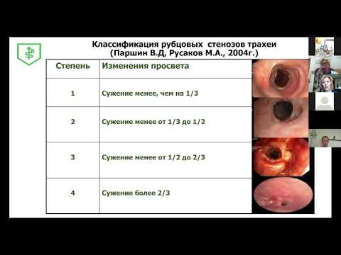 Видео: 3 Коржева ИЮ Современные возможности эндоскопии в лечении постинтубационных рубцовых стенозов трахеи