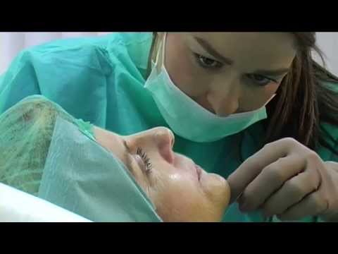 Видео: Лифтинг на шия с конци