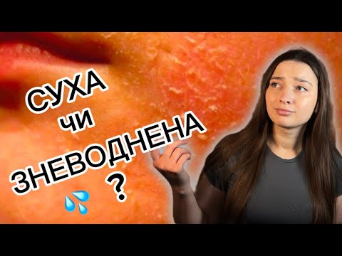 Видео: СУХА та ЗНЕВОДНЕНА ШКІРА: різниця і догляд.