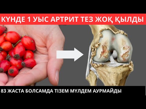 Видео: Буын ауырса не истеу керек? Буын ауруларын емдеу жолдары Бакзат Сейтказыулы