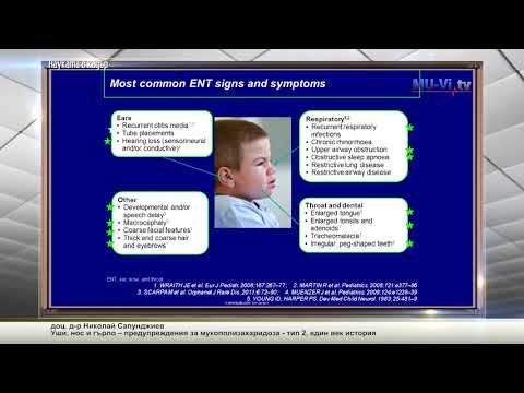 Видео: Уши, нос и гърло – предупреждения за мукополизахаридоза - тип 2, един век история