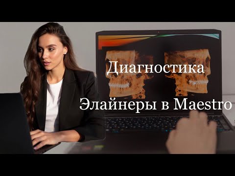 Видео: Моделирование элайнеров в Maestro, диагностика, как самый важный этап в создании сетапа.