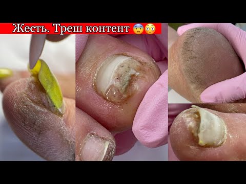 Видео: ТРЕШ контент😨 не для слабонервных 😓