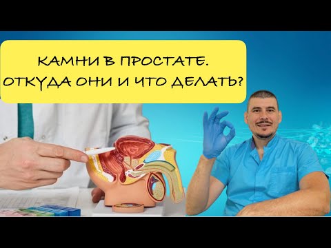 Видео: Камни простаты.Откуда они и что делать?