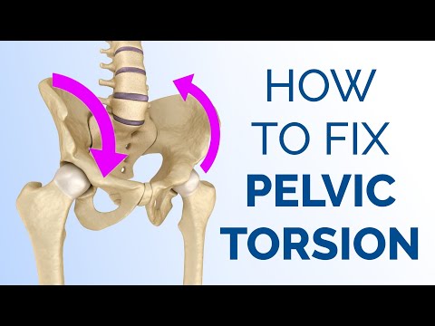 Видео: Исправление перекрута таза с помощью потягивания