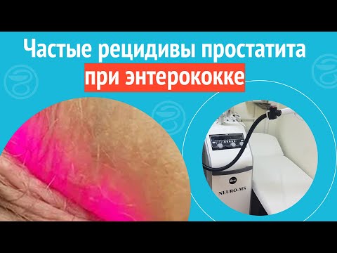 Видео: 😥 Частые рецидивы простатита при энтерококке. Клинический случай №1231