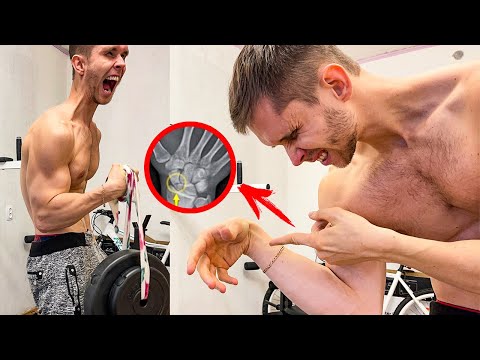 Видео: Ну вот и все...Надрыв связок! Забыть про Армрестлинг?