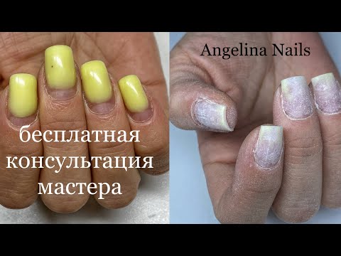 Видео: коррекция ногтей гелем / правильная архитектура форма квадрат / маникюр на коротких ногтях