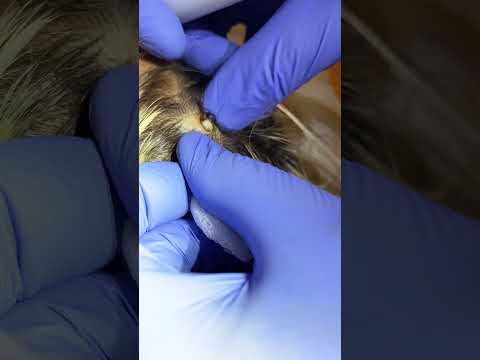 Видео: Удалили атерому на коже головы