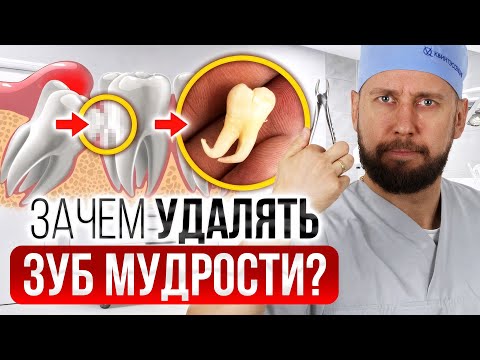 Видео: Удаляешь зуб МУДРОСТИ? Ни в коем случае не делай этого...