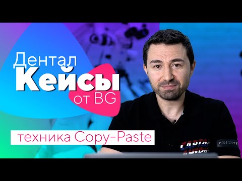 Видео: Дентал Кейсы от BG. Эстетическая реабилитация в технике Copy-Paste. #01