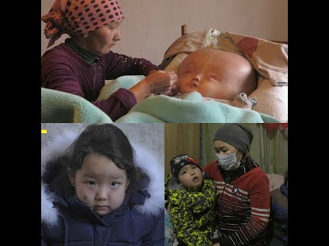 Видео: Жүрөктү титиреткен тагдырлар..\Эл билсин