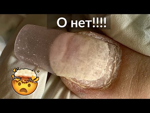 Видео: Ошибки в КОРРЕКЦИИ НОГТЕЙ