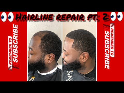 Видео: УХ ТЫ!!! ОН ВЫГЛЯДИТ КАК ДРУГОЙ ЧЕЛОВЕК ВОССТАНОВЛЕНИЕ ЛИНИИ ВОЛОС // РЕДЕЯЩИЕ ВОЛОСЫ // МУЖСКОЙ ...