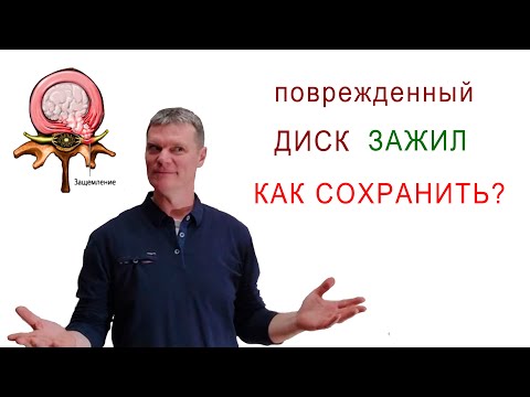 Видео: Профилактика травмы межпозвонкового диска
